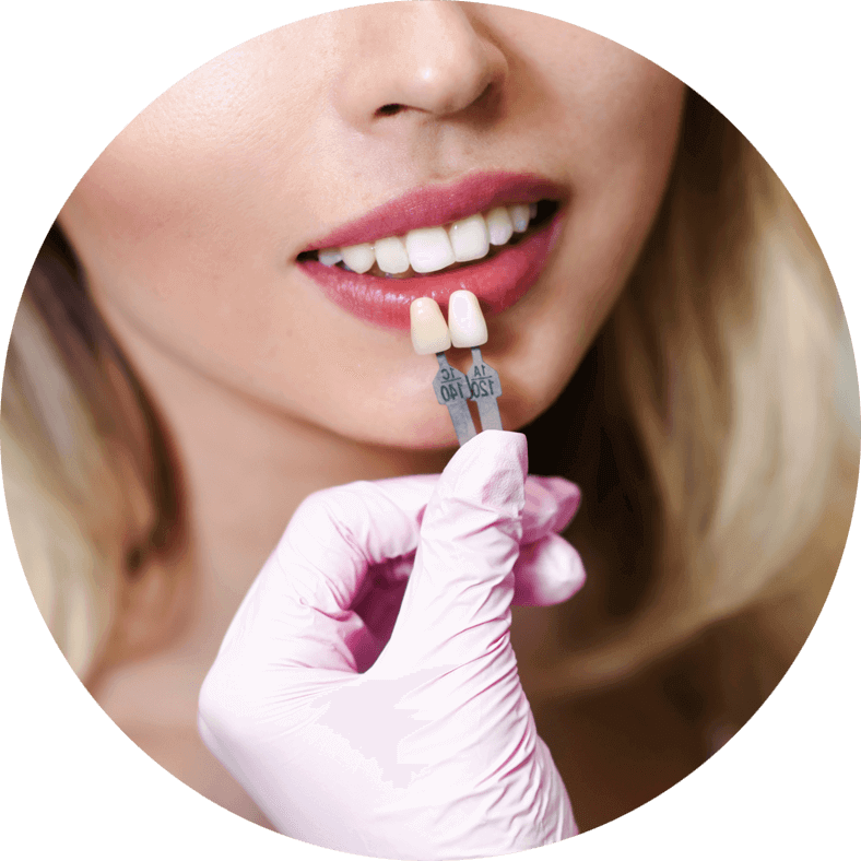 dental-patient-undergoing-veneers-procedure dental patient undergoing veneers procedure
