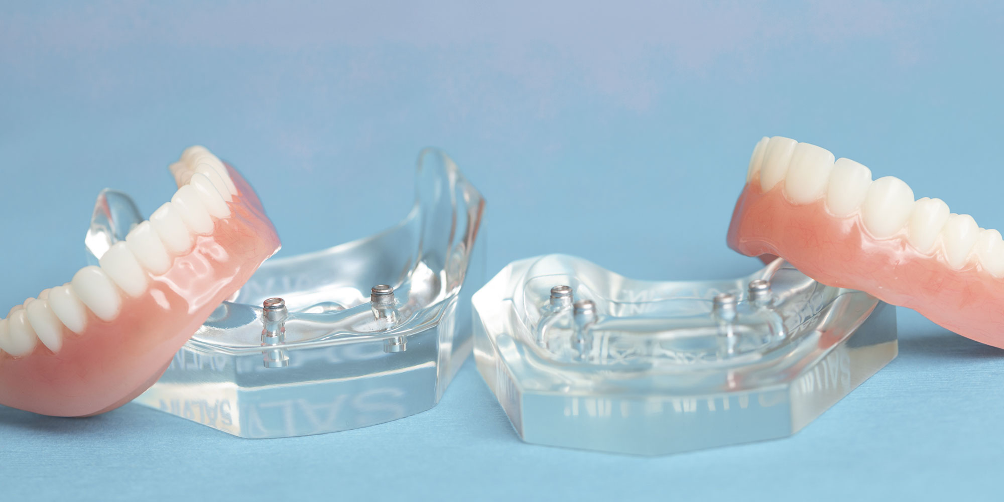 implant supported dentures