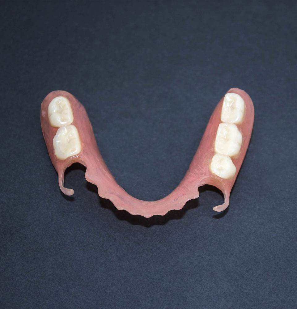 partial denture model