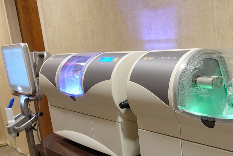cerec_dentaltech_drolson Cerec Dental Crown System
