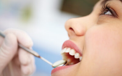 Three Reasons Why Porcelain Veneers Are a Game-Changer